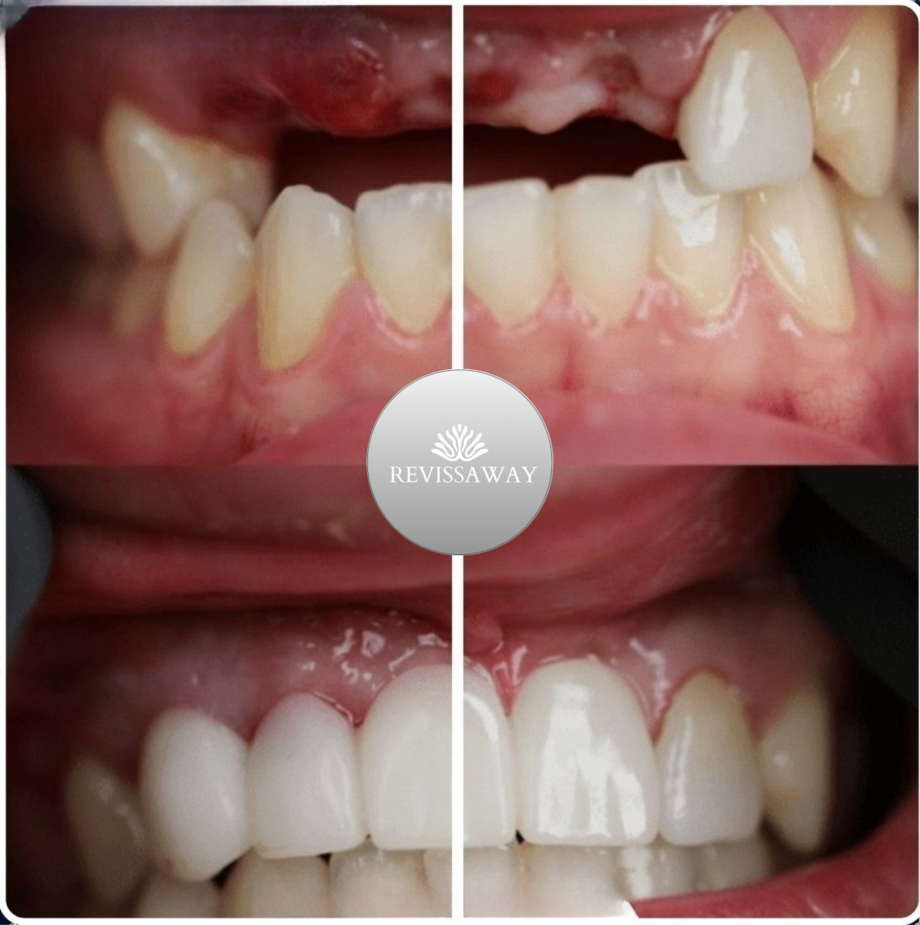 Smile Aesthetics Before & After 2