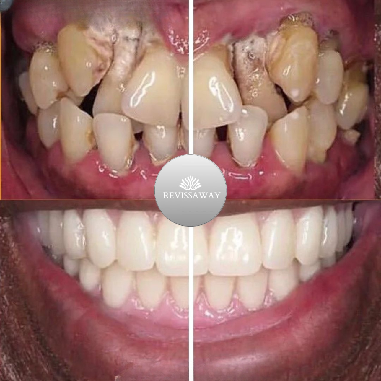 Smile Aesthetics Before & After 3